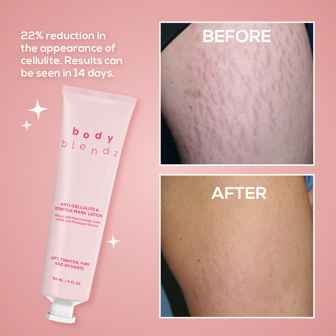 Firming Anti-Cellulite & Stretch Mark Lotion by BodyBlendz – 72-hour hydration, natural ingredients, and visible results for stretch marks and cellulite.